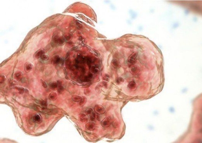 물놀이 비상…온천 다녀온 5세 여아, '뇌 먹는 아메바'에 혼수상태 