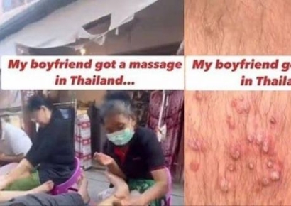 "동남아서 저렴한 마사지 신중해야"…의사 경고한 이유