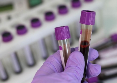 바이오 시밀러에 물 들어온다…"빅파마 특허 만료 306조 손실"