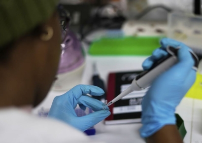 '사별 뒤 20년간 나혼자 살아'…의학계도 놀란 80대 여성 HIV 감염