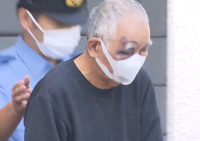 "그만 맞고 싶었다" 아들 살해 시도한 아버지…얼굴엔 선명한 피멍 자국이