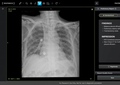 딥노이드, 생성형 AI 'M4CXR' 식약처 임상시험계획 승인