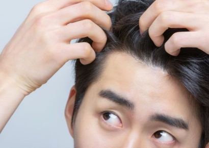 "흰 머리가 검은 머리 됐다" 여배우도 '효과'…전문가들 "흰머리 치료 근거 부족" 