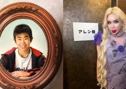 "학폭 가해자들 보고 있나?"…10억 들여 성형, 인플루언서로 변신한 日 남성