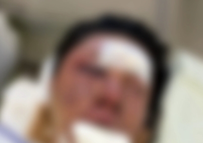 "손 묶고 가슴을 수차례…" 납치 상황 전말 공개한 유튜버