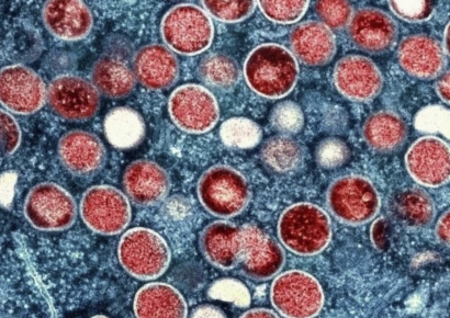 "걸리면 고열·발진" 사망자 201명인데…아시아에서 '새 변이' 발견