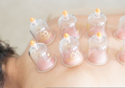 주사 이모? '침 삼촌'도 있었다…무면허로 한방 시술 중국인 징역형