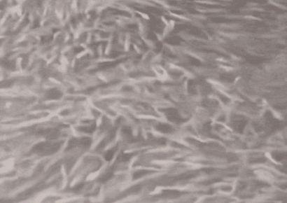 "강이 안 보일 정도" 갑자기 몰려든 물고기 떼…시민들 '멈칫'