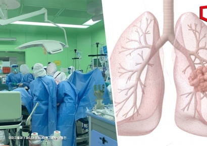 "제발 금연하세요"…15세부터 전자담배 피우다 피 토하고 폐 절제한 20대