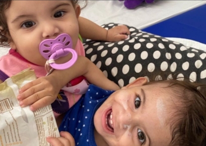 7개월 전 분리 수술 받은 브라질 샴쌍둥이 자매…모두 하늘나라로