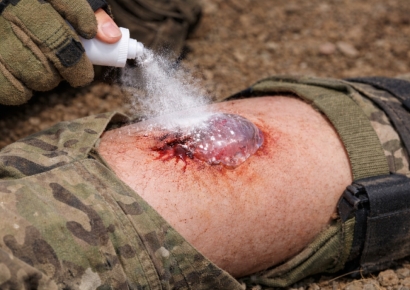"피 철철 나는 부상자에 파우더 톡톡"… '1초면 지혈 끝' 과다출혈 막을 혁신