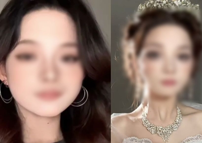 "메이크업 너무 잘하는데" 가짜 장애 의혹에 女 인플루언서 꺼내든 '이것'