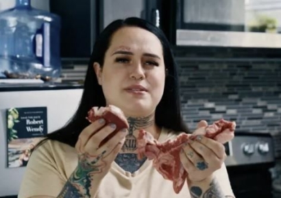 매일 생고기 900g 먹던 美 여성…건강 검진 결과 '충격'