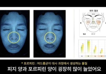 "7일 만에 피부 나이 5살 늙어"…피부과 의사 직접 실험했다