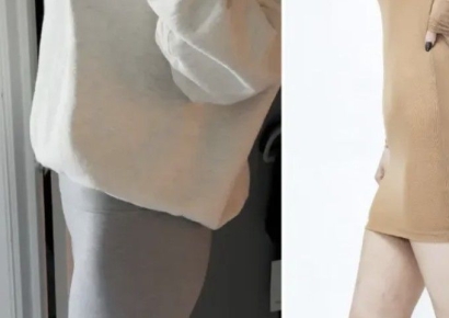 6600만원짜리 요즘 유행하는 '기괴한 성형'…"시신 지방으로 볼륨 빵빵하게"