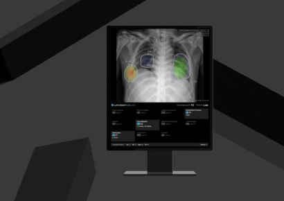 루닛, 국내 원격영상판독 센터에 AI솔루션 공급