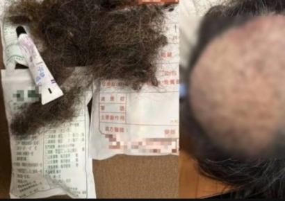 "식당 악취에 머리 빠졌다"…탈모 사진 공개에 논란 확산, 악취 기준치의 '10배'