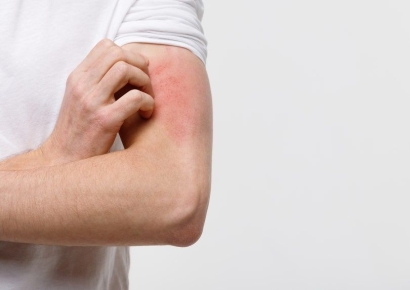 "치료 어려운데, 벌써 14명 확진"…성관계 후 '희귀 곰팡이' 집단감염 우려에 美 비상