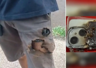 대형견 습격 순간 갑자기 '펑'…주머니 속 '이것' 폭발 덕분에 브라질 남성 위기 넘겨