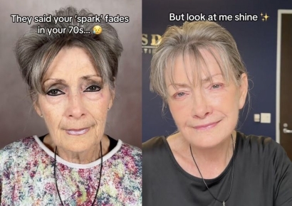 "30년을 되돌렸다"…안면거상술로 변신한 70대 여성 '화제'