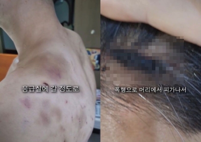 "도망치면 가족까지…" 부산 중식당서 수년간 직원 폭행·협박 의혹
