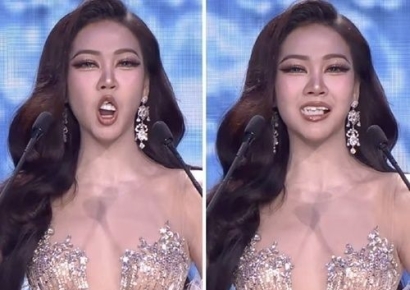 혹시 틀니? 미인대회 참가자 입에서 치아가 '툭'…침착한 대처에 '박수'