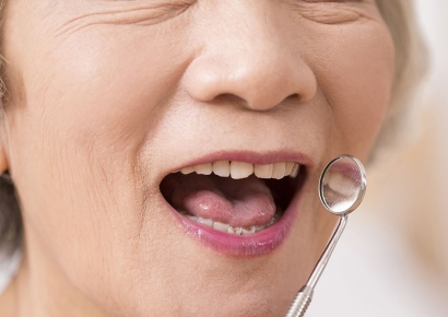 치과의사의 고민, 뽑을까 말까?… 사랑니·기울어진 치아, 난발치