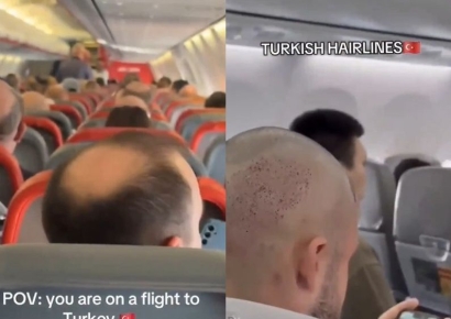 튀르키예行 비행기에는 대머리 손님 뿐…이유 뭐길래