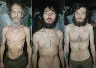 "식량 없이 빗물로 17일 버텨"…영양실조 병사들 모습에 우크라 '발칵'