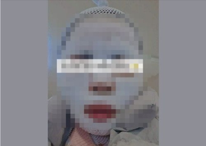 얼굴에 끓는 물 부은 남편 감쌌는데 입장 바꿨다…'태국인 아내 중화상 재판' 다시 열린다