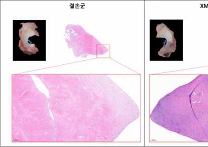 엠젠솔루션, 전임상서 생체조직 유래 반월상 연골판 이식재 안전성·유효성 확인